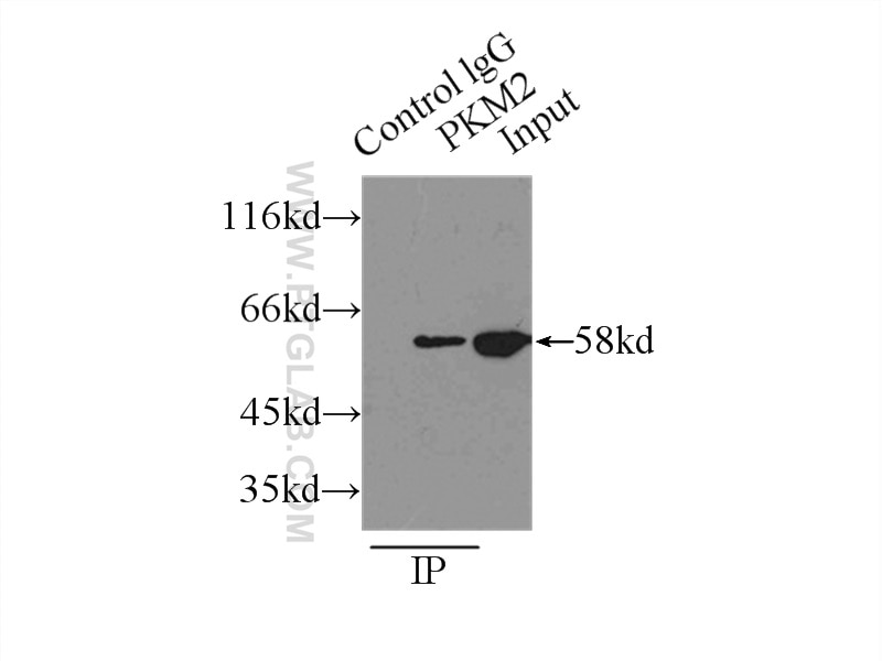 Immunoprecipitation (IP) experiment of MCF-7 cells using PKM2-specific Polyclonal antibody (15822-1-AP)