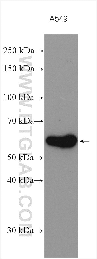 Western Blot (WB) analysis of various lysates using PKM2-specific Polyclonal antibody (15822-1-AP)