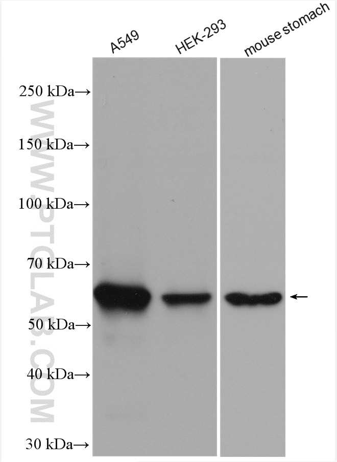 Western Blot (WB) analysis of various lysates using PKM2-specific Polyclonal antibody (15822-1-AP)