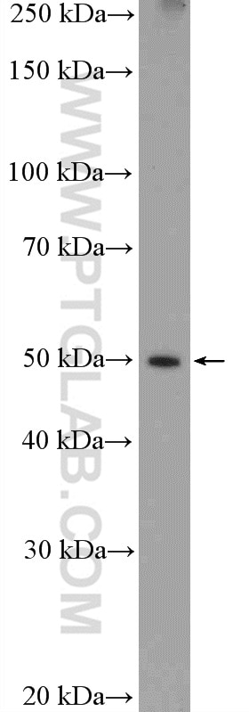 Western Blot (WB) analysis of C6 cells using PKM2-specific Polyclonal antibody (15822-1-AP)