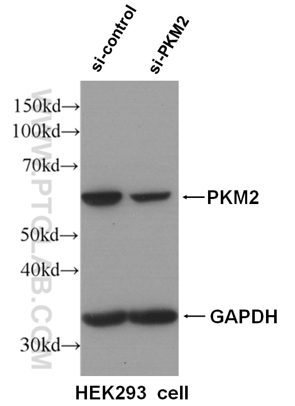 Western Blot (WB) analysis of HEK-293 cells using PKM2-specific Polyclonal antibody (15822-1-AP)