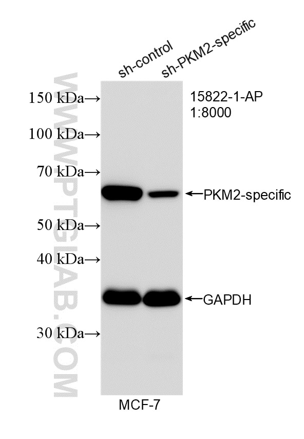 WB analysis of MCF-7 using 15822-1-AP Western Blot (WB) analysis of MCF-7 cells using PKM2-specific Polyclonal antibody (15822-1-AP)