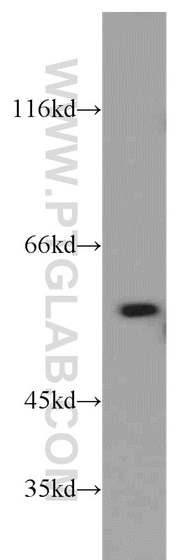 Western Blot (WB) analysis of HeLa cells using PKM2-specific Polyclonal antibody (15822-1-AP)