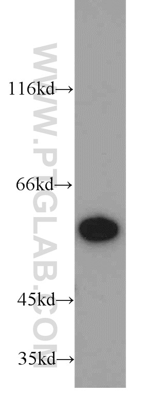 Western Blot (WB) analysis of MCF-7 cells using PKM2-specific Polyclonal antibody (15822-1-AP)