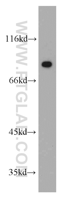 WB analysis of Recombinant protein using 15822-1-AP