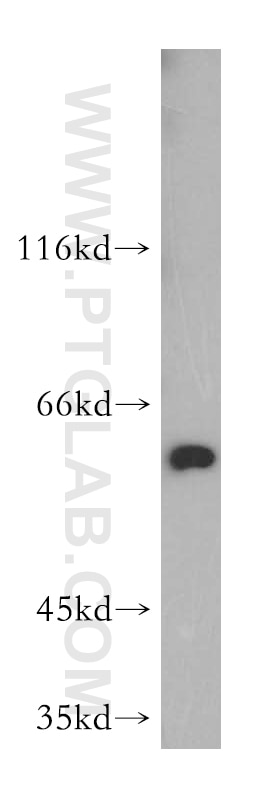 Western Blot (WB) analysis of HEK-293 cells using PKM2-specific Polyclonal antibody (15822-1-AP)