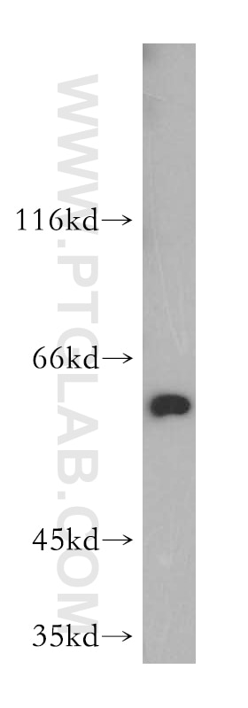 WB analysis of HEK-293 using 15822-1-AP