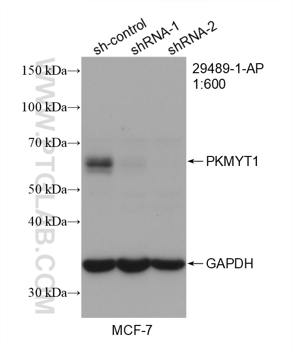 Western Blot (WB) analysis of MCF-7 cells using PKMYT1 Polyclonal antibody (29489-1-AP)