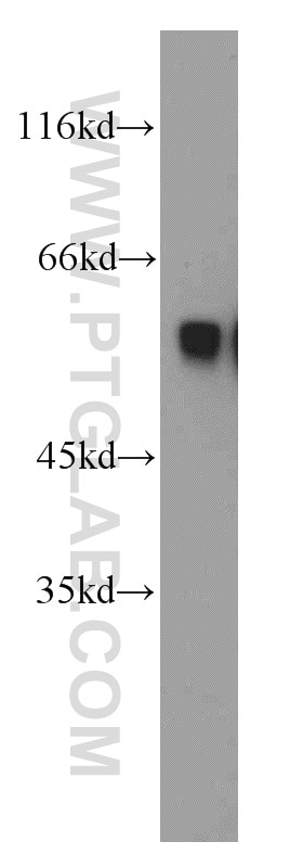 Western Blot (WB) analysis of mouse brain tissue using PKMYT1 Polyclonal antibody (55098-1-AP)