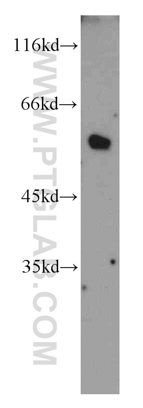Western Blot (WB) analysis of HepG2 cells using PKMYT1 Polyclonal antibody (55098-1-AP)