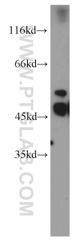 Western Blot (WB) analysis of HL-60 cells using PKMYT1 Polyclonal antibody (55098-1-AP)