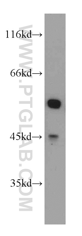 Western Blot (WB) analysis of HeLa cells using PKMYT1 Polyclonal antibody (55098-1-AP)