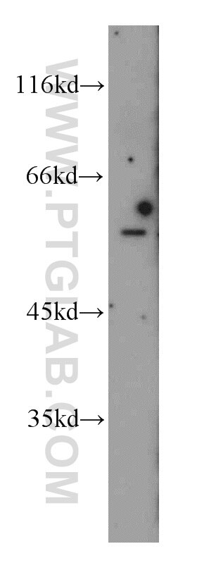 Western Blot (WB) analysis of mouse skin tissue using PKMYT1 Polyclonal antibody (55098-1-AP)
