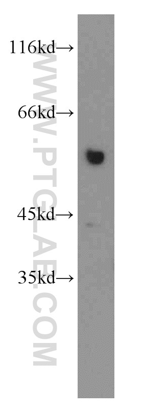 Western Blot (WB) analysis of A375 cells using PKMYT1 Polyclonal antibody (55098-1-AP)