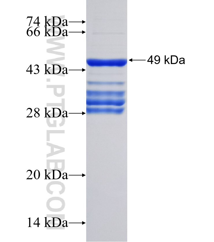 PKMYT1 fusion protein Ag30573 SDS-PAGE