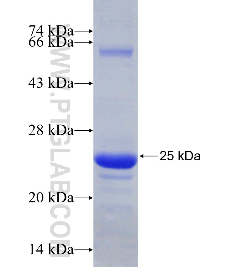 PKMYT1 fusion protein Ag30849 SDS-PAGE