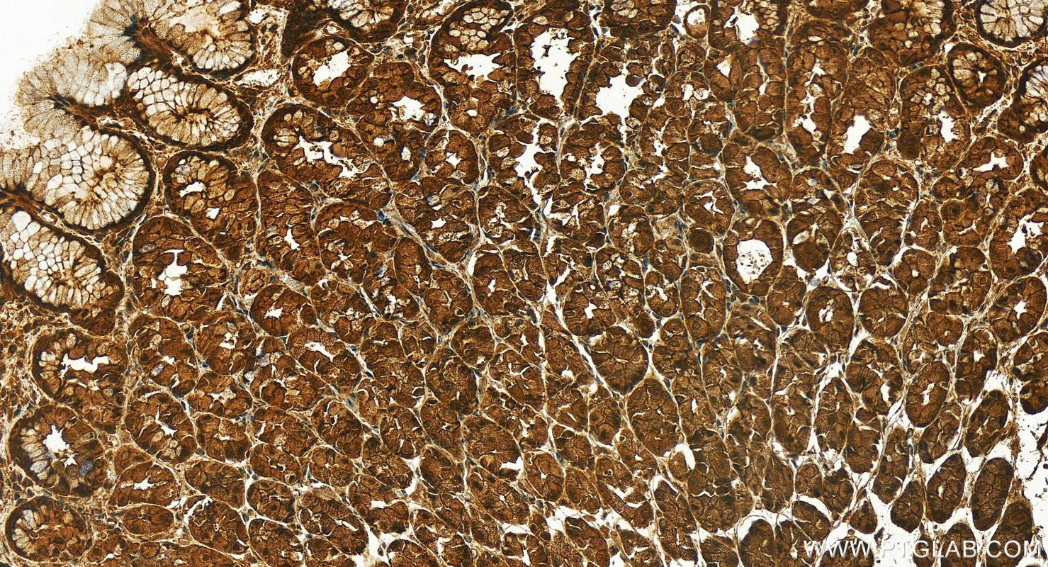 Immunohistochemistry (IHC) staining of human stomach tissue using PKN2 Polyclonal antibody (14608-1-AP)
