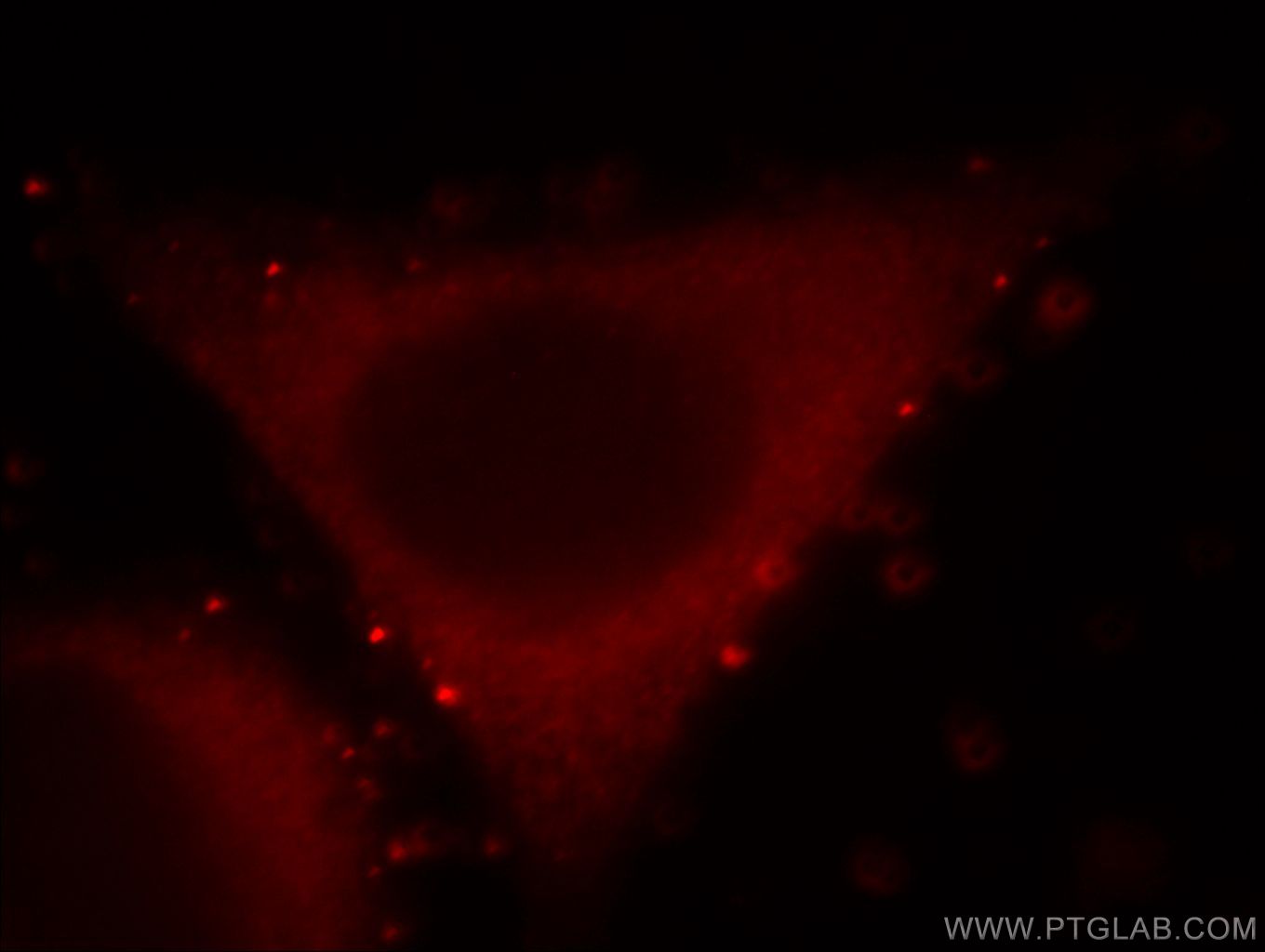 Immunofluorescence (IF) / fluorescent staining of HepG2 cells using PKN2 Polyclonal antibody (14608-1-AP)