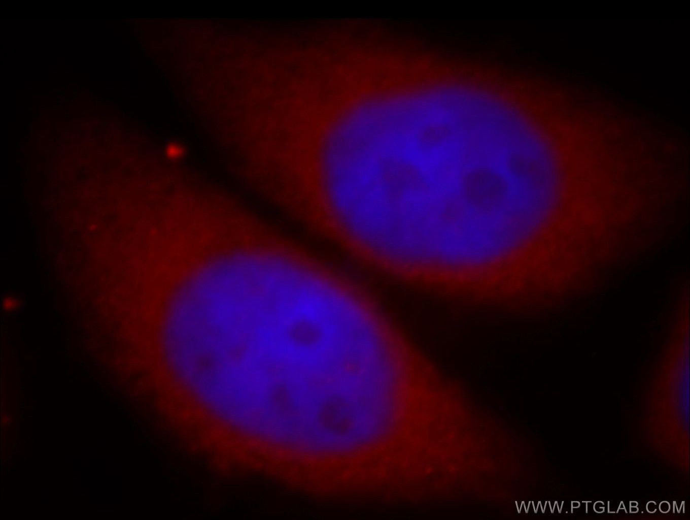 Immunofluorescence (IF) / fluorescent staining of HeLa cells using PKN2 Polyclonal antibody (14608-1-AP)