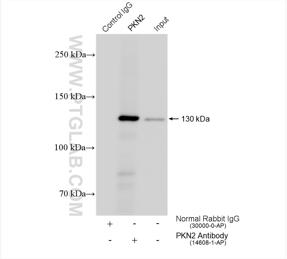 Immunoprecipitation (IP) experiment of COLO 320 cells using PKN2 Polyclonal antibody (14608-1-AP)