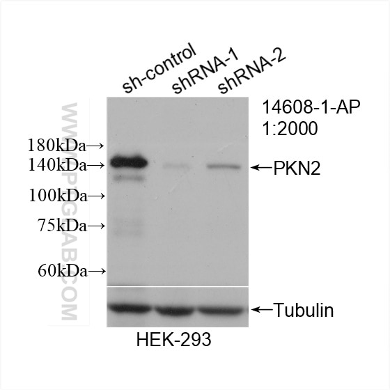 Western Blot (WB) analysis of HEK-293 cells using PKN2 Polyclonal antibody (14608-1-AP)