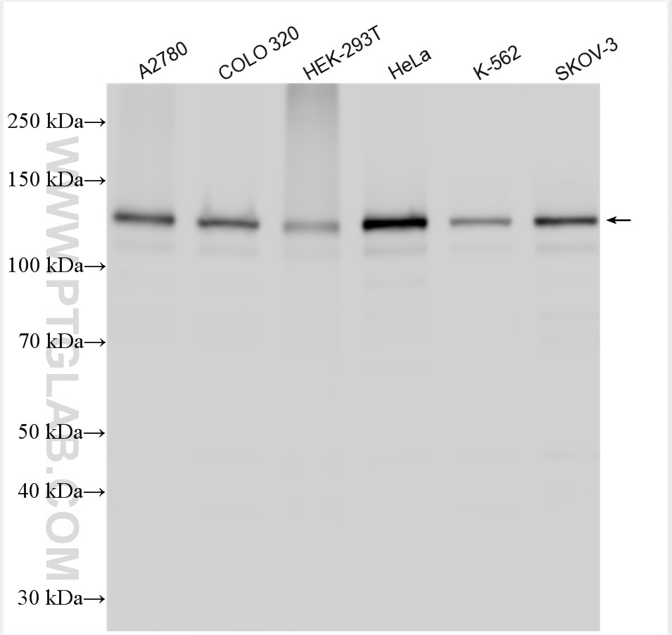 Western Blot (WB) analysis of various lysates using PKN2 Polyclonal antibody (14608-1-AP)