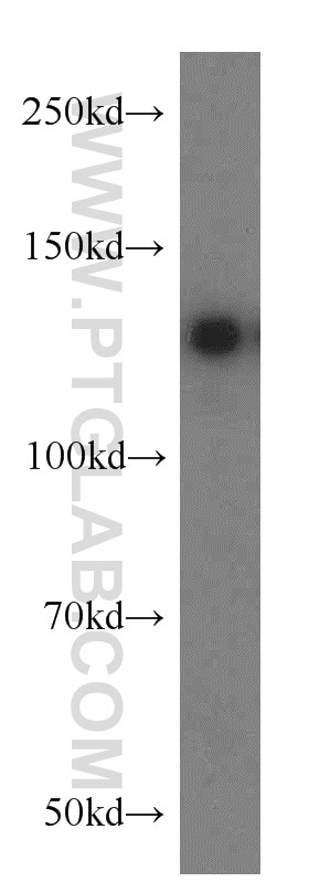 Western Blot (WB) analysis of HeLa cells using PKN2 Polyclonal antibody (14608-1-AP)