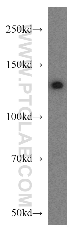 Western Blot (WB) analysis of K-562 cells using PKN2 Polyclonal antibody (14608-1-AP)