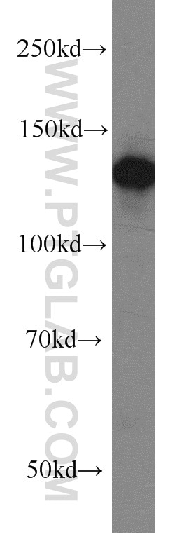 Western Blot (WB) analysis of COLO 320 cells using PKN2 Polyclonal antibody (14608-1-AP)