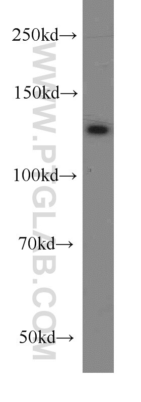 Western Blot (WB) analysis of SKOV-3 cells using PKN2 Polyclonal antibody (14608-1-AP)