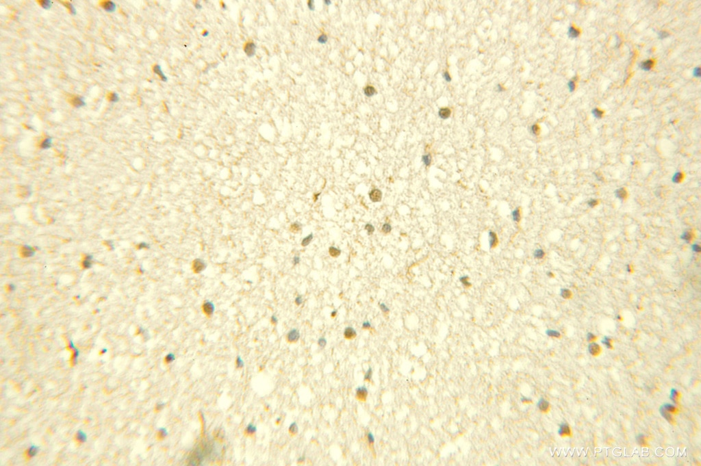 PKNOX1 Polyclonal antibody