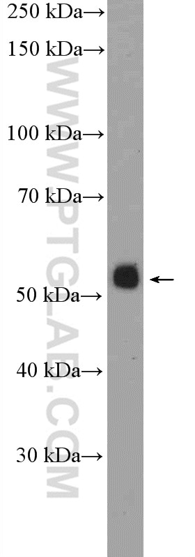 Western Blot (WB) analysis of COLO 320 cells using PKNOX1 Polyclonal antibody (10614-1-AP)
