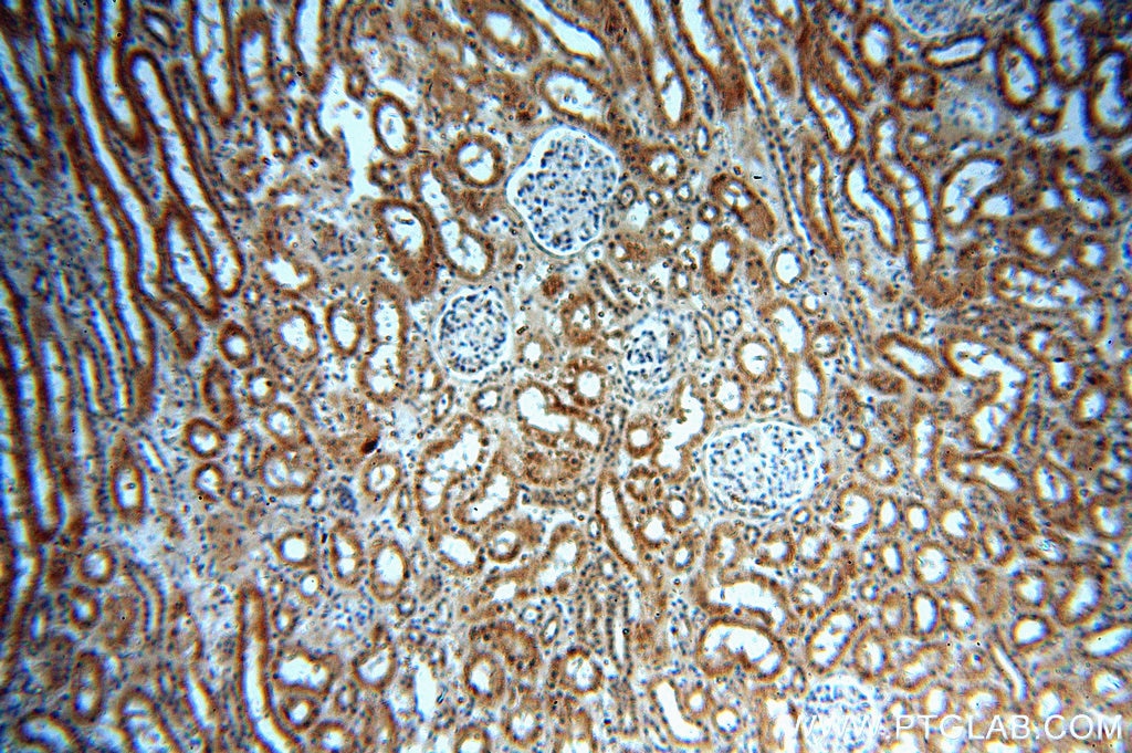 Immunohistochemistry (IHC) staining of human kidney tissue using PKNOX2 Polyclonal antibody (20352-1-AP)