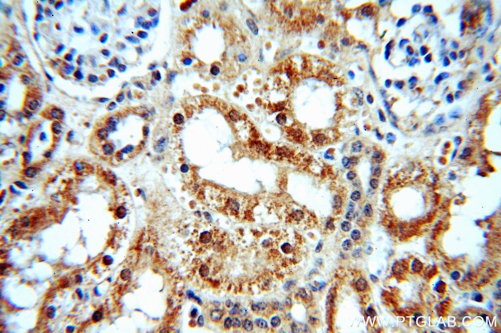 Immunohistochemistry (IHC) staining of human kidney tissue using PKNOX2 Polyclonal antibody (20352-1-AP)