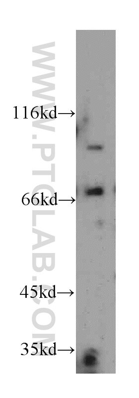 Western Blot (WB) analysis of HeLa cells using PKNOX2 Polyclonal antibody (20352-1-AP)