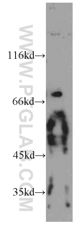 Western Blot (WB) analysis of mouse brain tissue using PKNOX2 Polyclonal antibody (20352-1-AP)