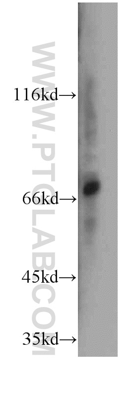 Western Blot (WB) analysis of mouse lung tissue using PKNOX2 Polyclonal antibody (20352-1-AP)