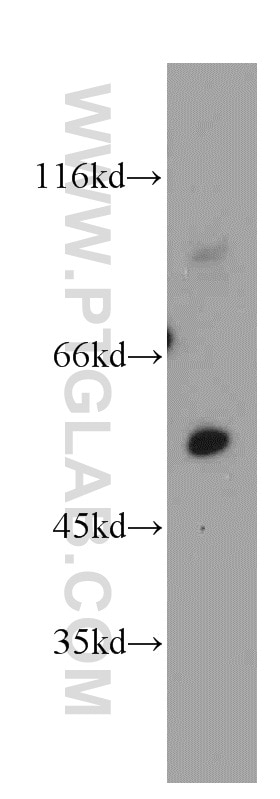 Western Blot (WB) analysis of human skeletal muscle tissue using PKNOX2 Polyclonal antibody (20352-1-AP)