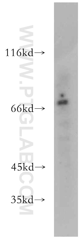 Western Blot (WB) analysis of mouse small intestine tissue using PKNOX2 Polyclonal antibody (20352-1-AP)