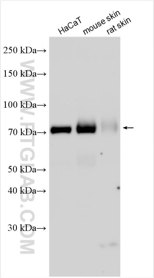 Western Blot (WB) analysis of various lysates using PKP1 Polyclonal antibody (22632-1-AP)
