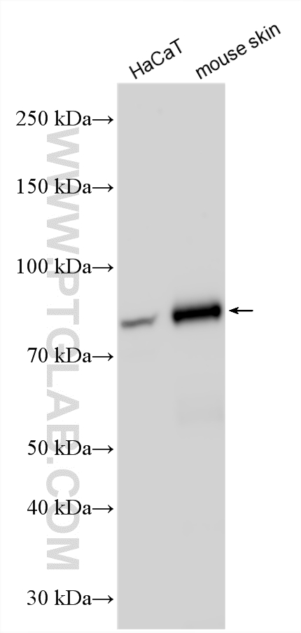 Western Blot (WB) analysis of various lysates using Plakophilin 1 Polyclonal antibody (22632-1-AP)
