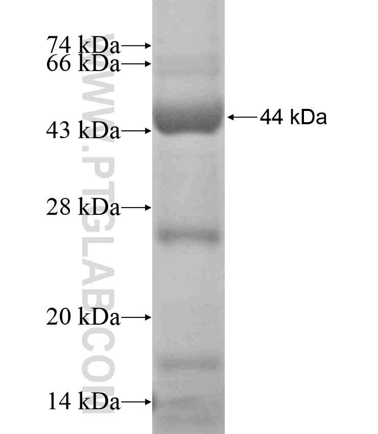 PKP1 fusion protein Ag18153 SDS-PAGE
