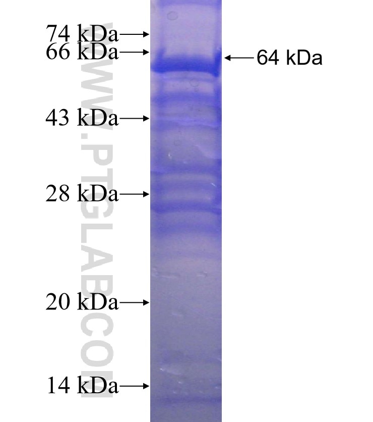 PKP2 fusion protein Ag24155 SDS-PAGE