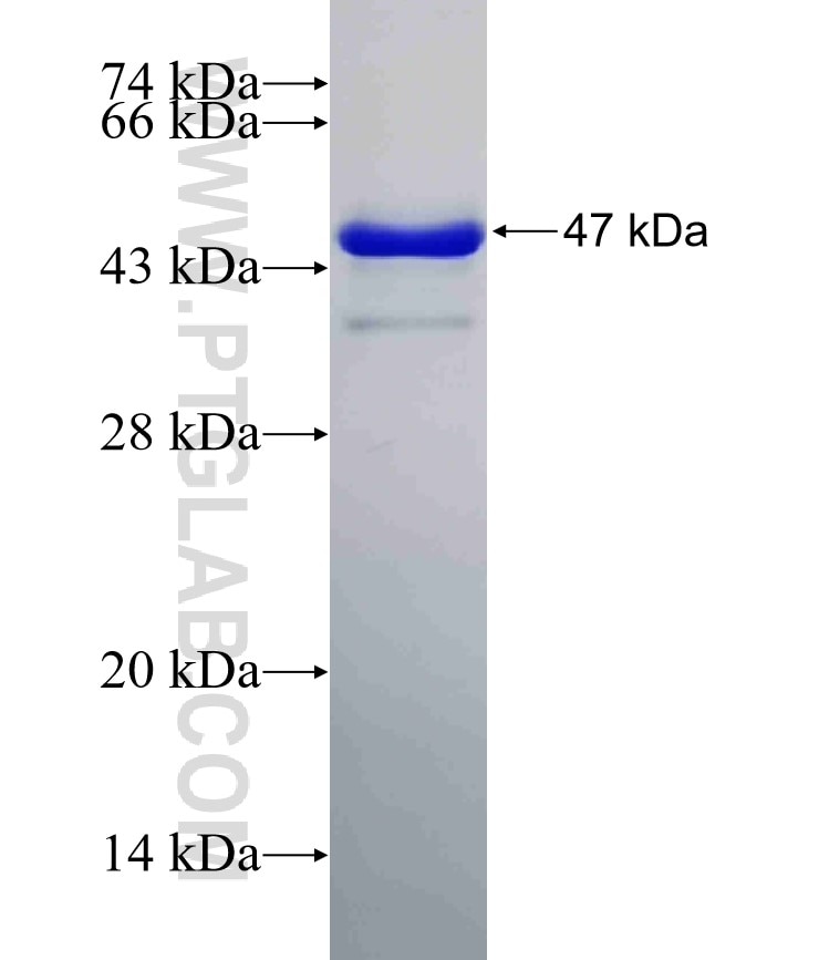 PKP2 fusion protein Ag24163 SDS-PAGE