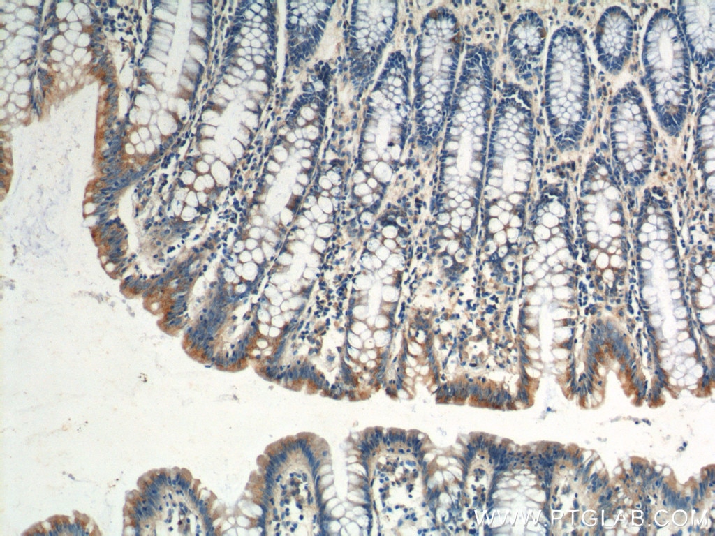 Immunohistochemistry (IHC) staining of human colon tissue using Plakophilin 3 Polyclonal antibody (18338-1-AP)