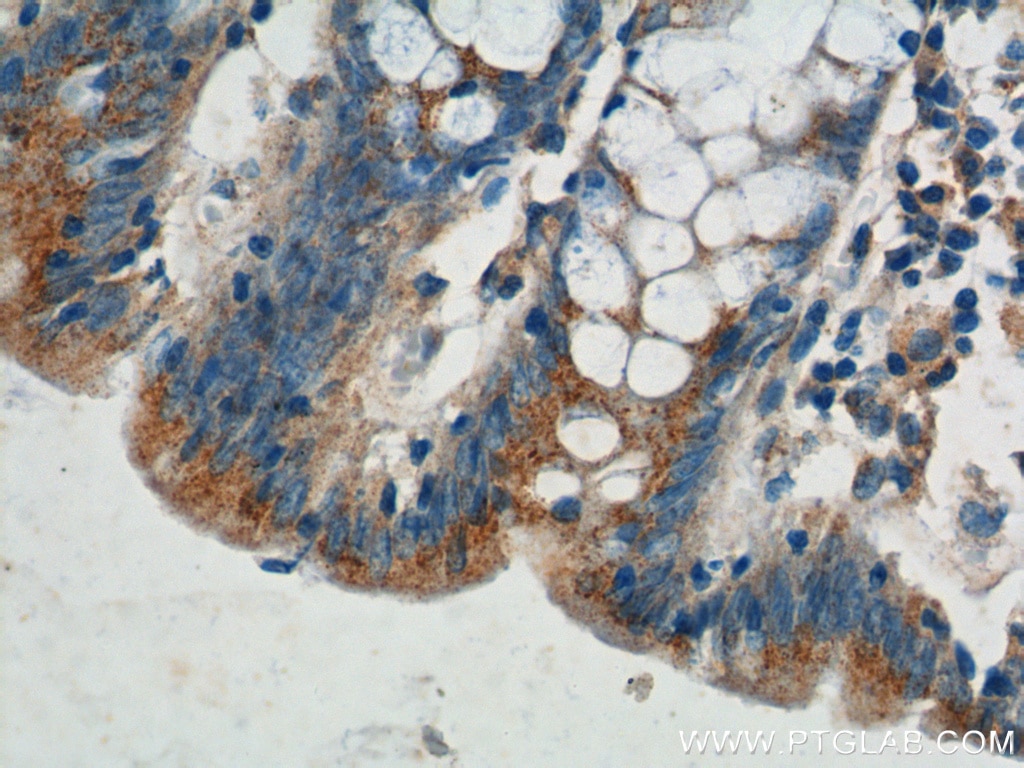 Immunohistochemistry (IHC) staining of human colon tissue using Plakophilin 3 Polyclonal antibody (18338-1-AP)