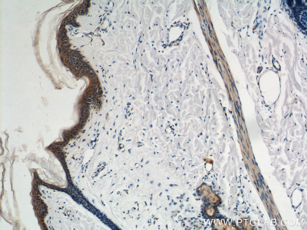 Immunohistochemistry (IHC) staining of human skin tissue using Plakophilin 3 Polyclonal antibody (18338-1-AP)