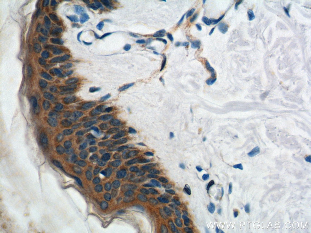 Immunohistochemistry (IHC) staining of human skin tissue using Plakophilin 3 Polyclonal antibody (18338-1-AP)
