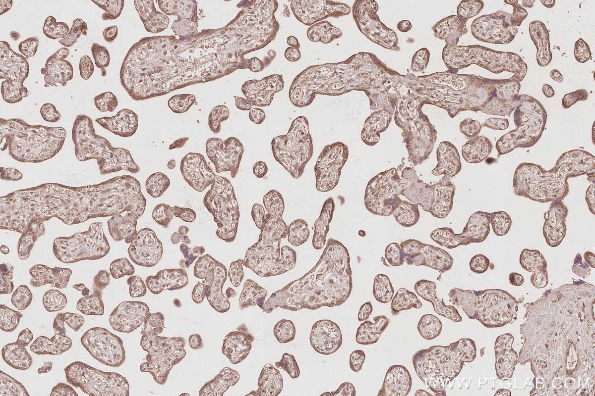 Immunohistochemistry (IHC) staining of human placenta tissue using Plakophilin 3 Polyclonal antibody (18338-1-AP)