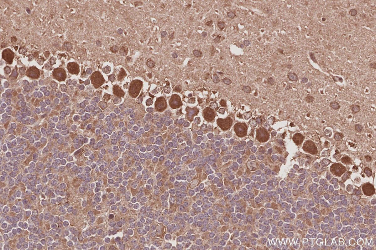 Immunohistochemistry (IHC) staining of mouse cerebellum tissue using Plakophilin 3 Polyclonal antibody (18338-1-AP)